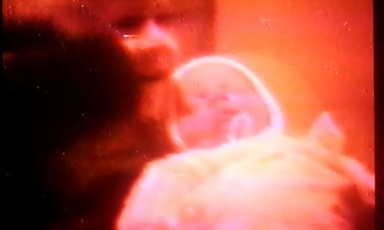 Boards of Canada - 1986 Summer Fire